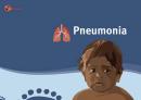 Pneumonia